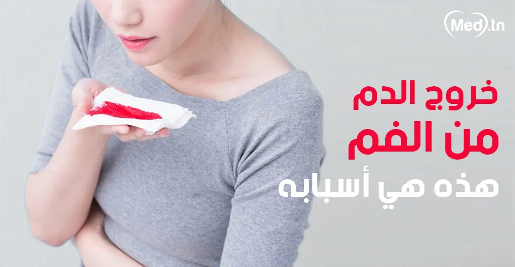 خروج الدم من الفم هذه هي أسبابه